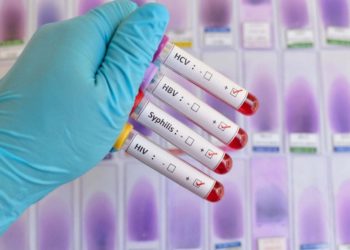 Sifilide in aumento vertiginoso in Europa: +70% dal 2010. Il morbo gallico fa ancora paura