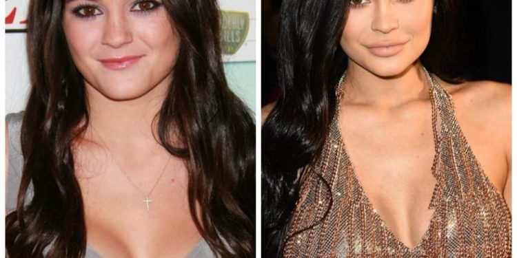 Are these photos proof that Kylie Jenner has had plastic surgery?