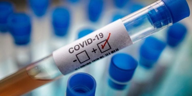 Test covid 19
