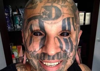 Il rapper scarnificato