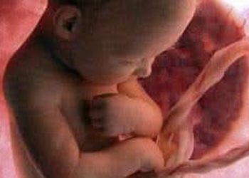 Testimonianza di una donna che ha abortito 